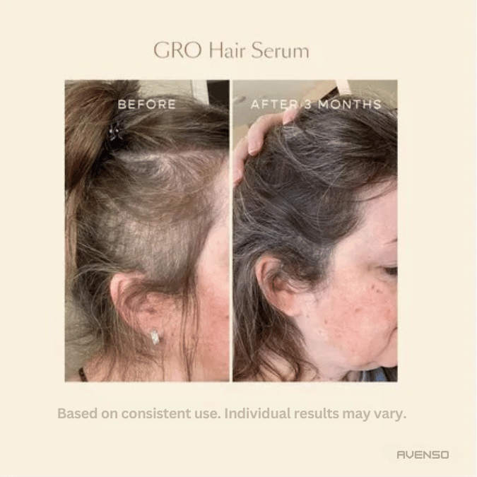 GRO - Hair Growth & Strength Serum